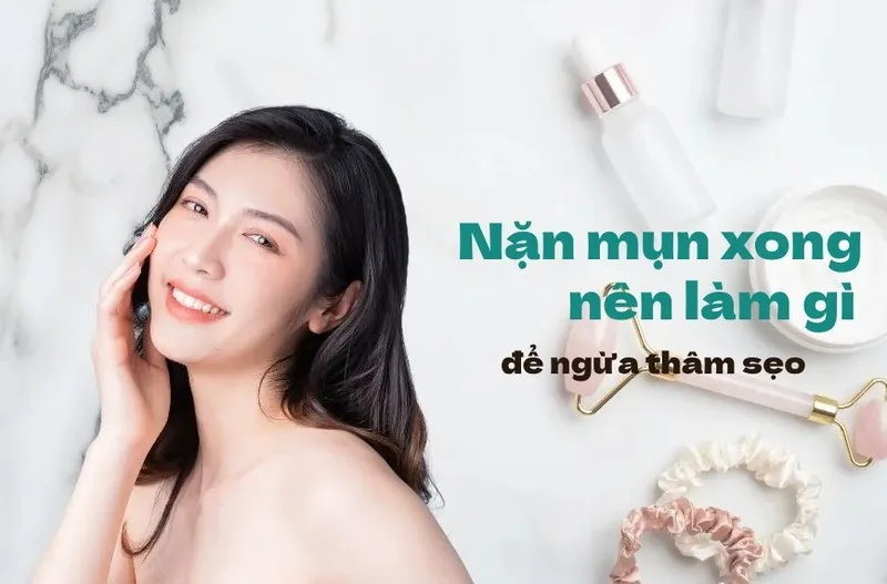 Nặn mụn xong nên làm gì để da nhanh dịu và không thâm sẹo
