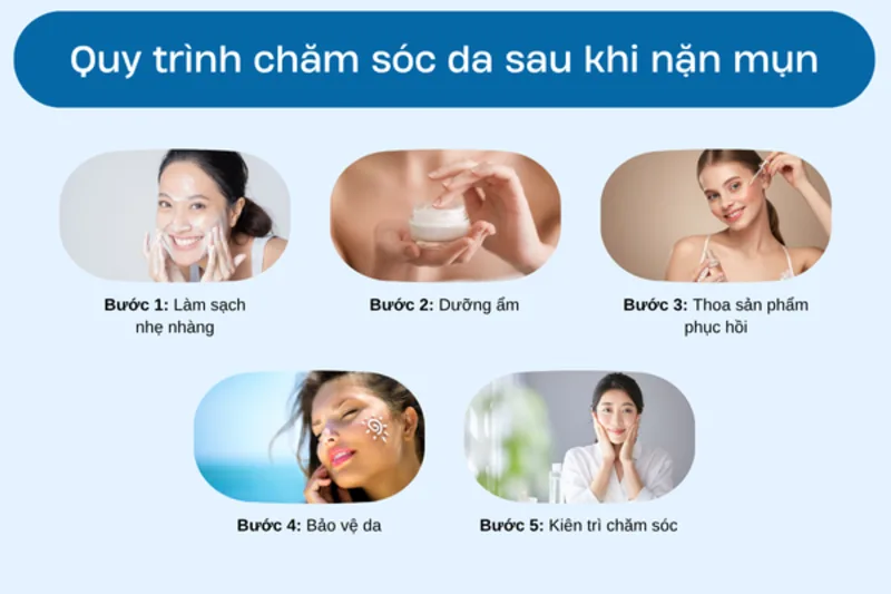 Quy trình chăm sóc sau nặn mụn nên đơn giản, chia theo từng giai đoạn để da có thời gian phục hồi.
