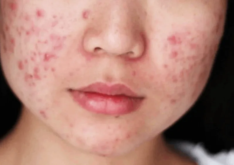 Mủ bất thường, đau nhiều, nóng đỏ hoặc đỏ lan là dấu hiệu cần được kiểm tra y tế.